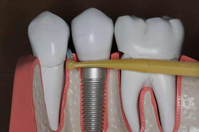 1583719917549656.jpg timg.jpg