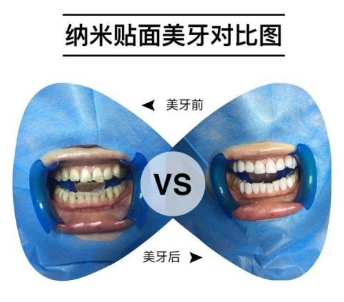 1583720524457904.png 微信图片_20200309102015.png