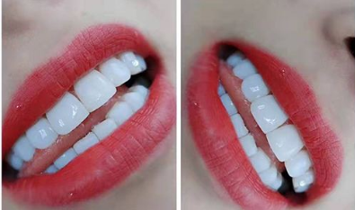 1583720537238292.png 微信图片_20200309101841.png