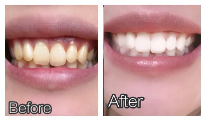 1606552373189601.jpg initpintu_副本.jpg