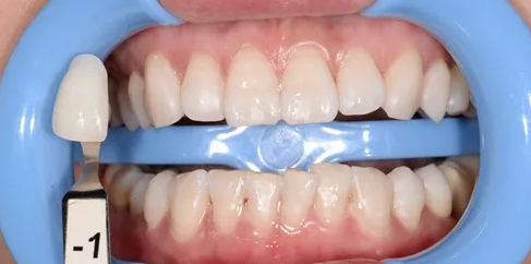 1606552322103236.png 微信图片_20201026095858.png