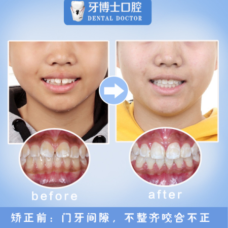 1606552106275045.jpg 美团矫正5.jpg