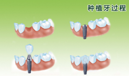 1606551989960958.png 1-1Q12913461Q61.png